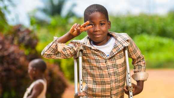 gangguan mobilitas fisik seperti apa